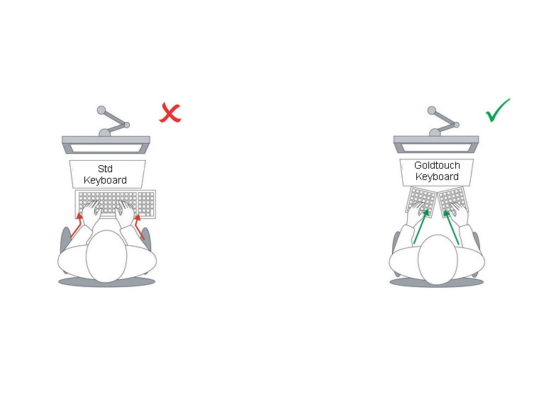 Goldtouch Posture Keyboard - Image 5